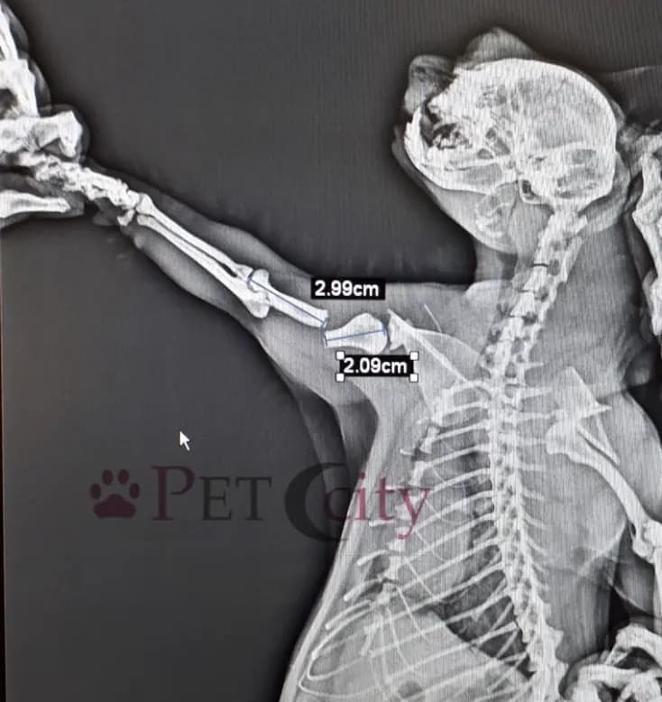 Bilbo'nun Humerus Kırığı ve Başarılı Operasyonu